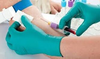Cerca de sangue da veia do cotovelo