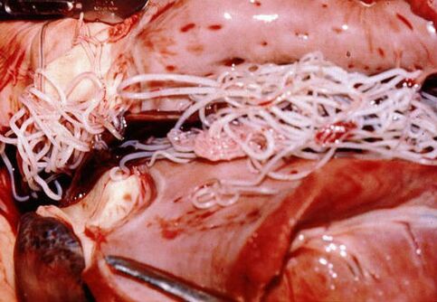 parasitas no corpo humano