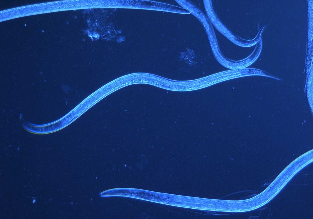 tricurídeo humano